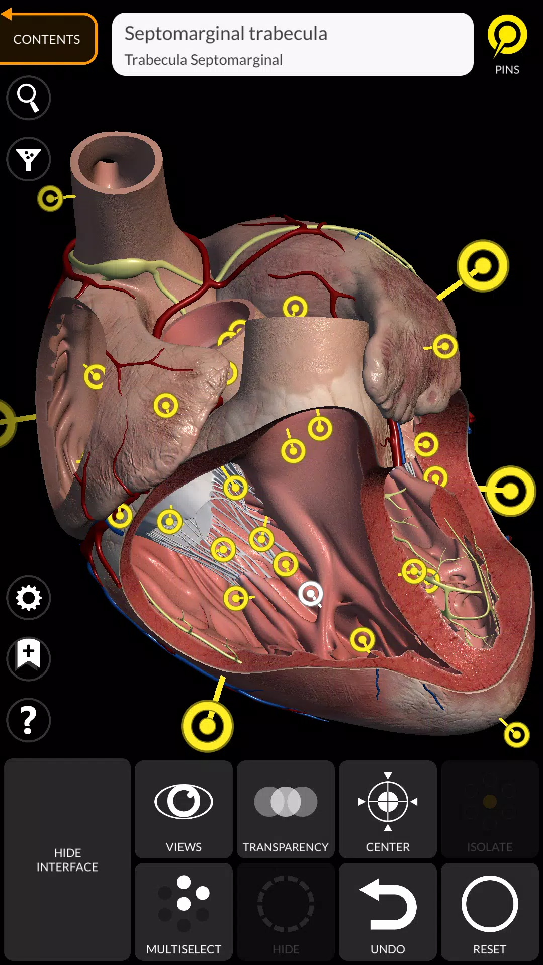 Anatomy 3D Atlas ဖန်သားပြင်ဓာတ်ပုံ 2